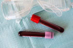 Jak dokonać interpretacji badań krwi w Internecie?